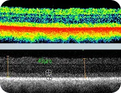 光干渉断層計検査（OCT検査）
