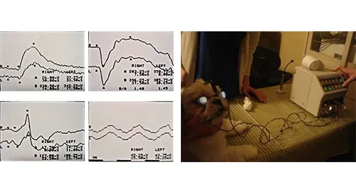 網膜電図検査